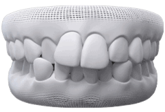 Invisalign | Invisalign in Guelph