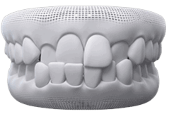 Invisalign | Invisalign in Guelph