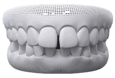 Invisalign | Invisalign in Guelph