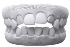 Invisalign | Invisalign in Guelph
